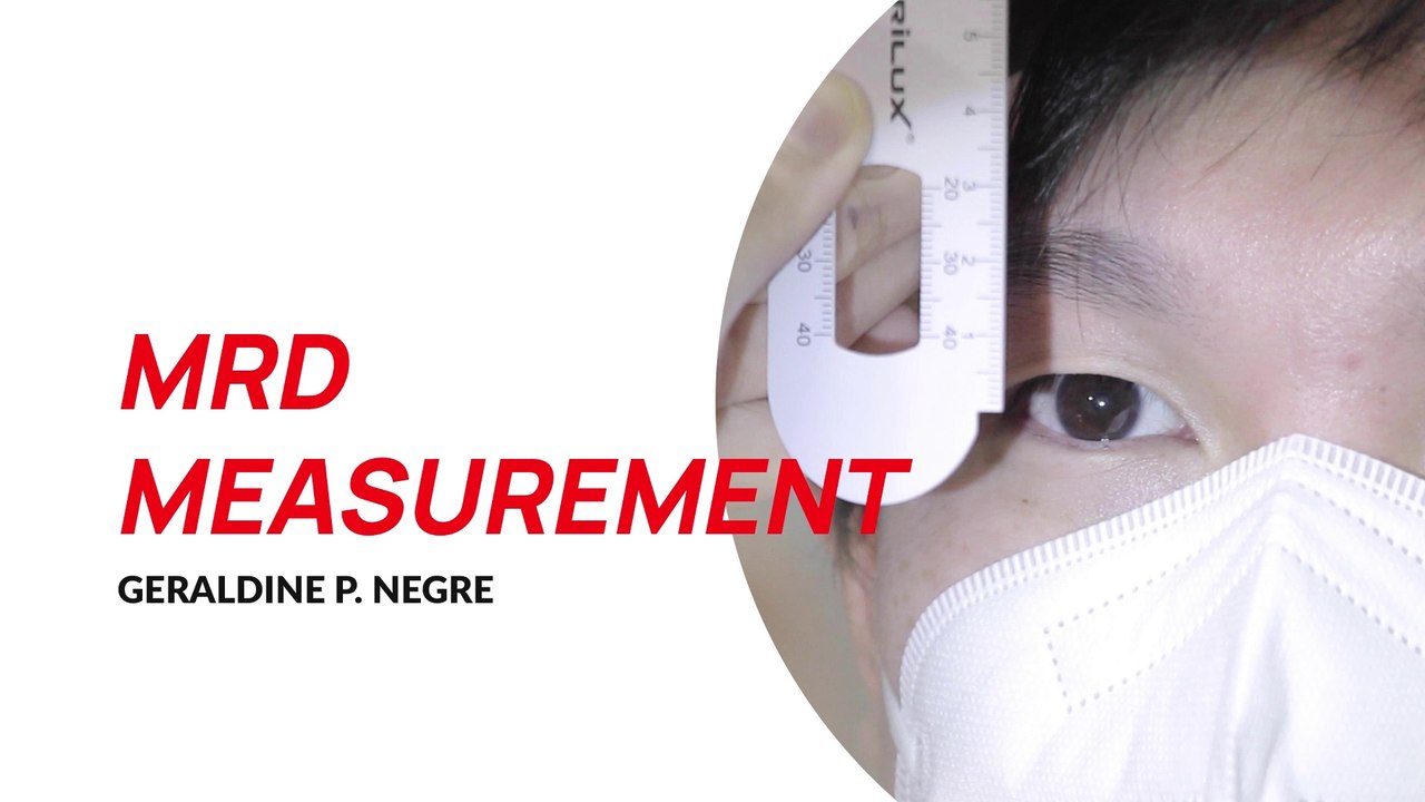 Module 3 - MRD measurement EAMC - video Dailymotion