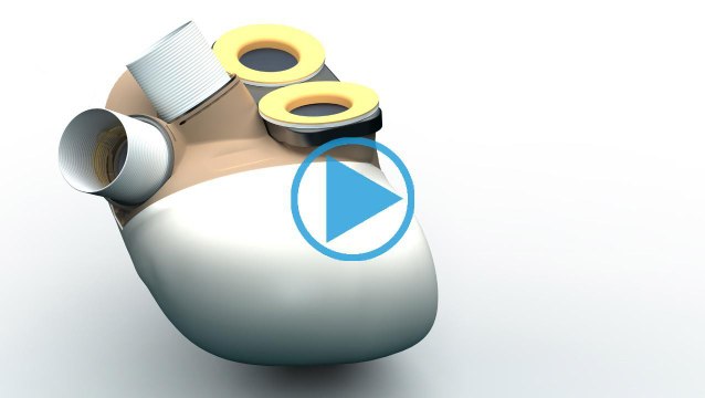 Coeur artificiel : Carmat peut reprendre ses essais cliniques