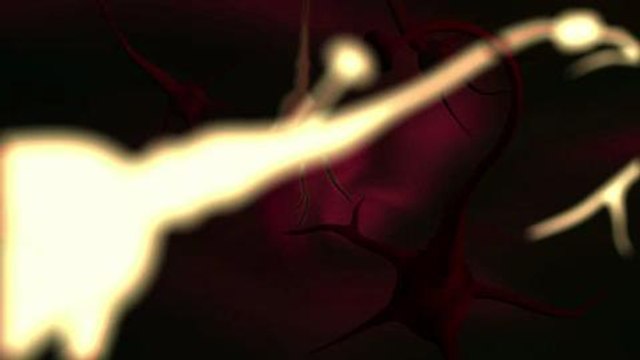 La maladie d'Alzheimer