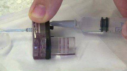 Un "pancréas articificiel" testé par des diabétiques