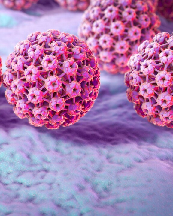 CAM - Est-ce que c’est grave d’avoir un papillomavirus ?