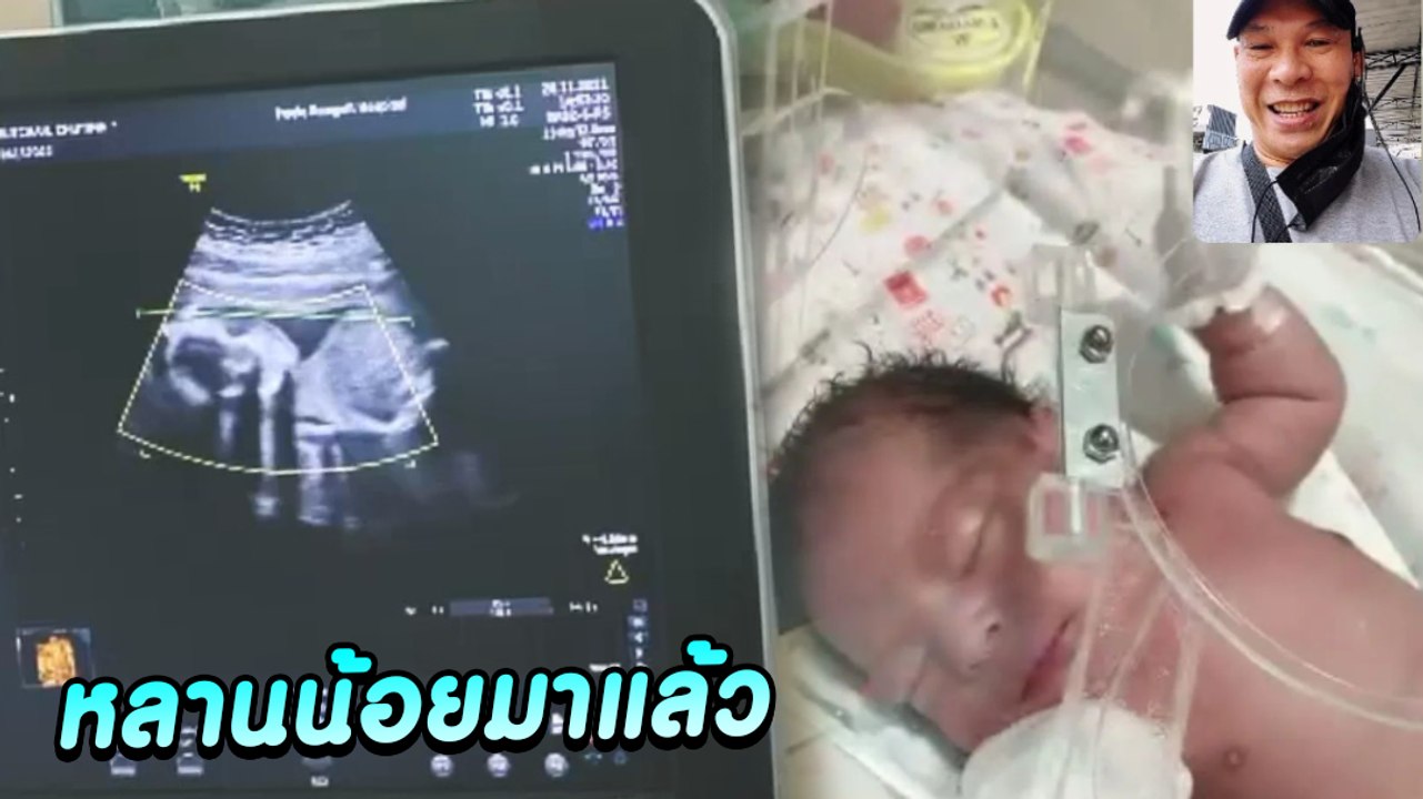 ภาพอัลตราซาวด์ น้องบะหมี่หลาน โหน่ง ชะชะช่า กลายเป็นคุณปู่แล้วว