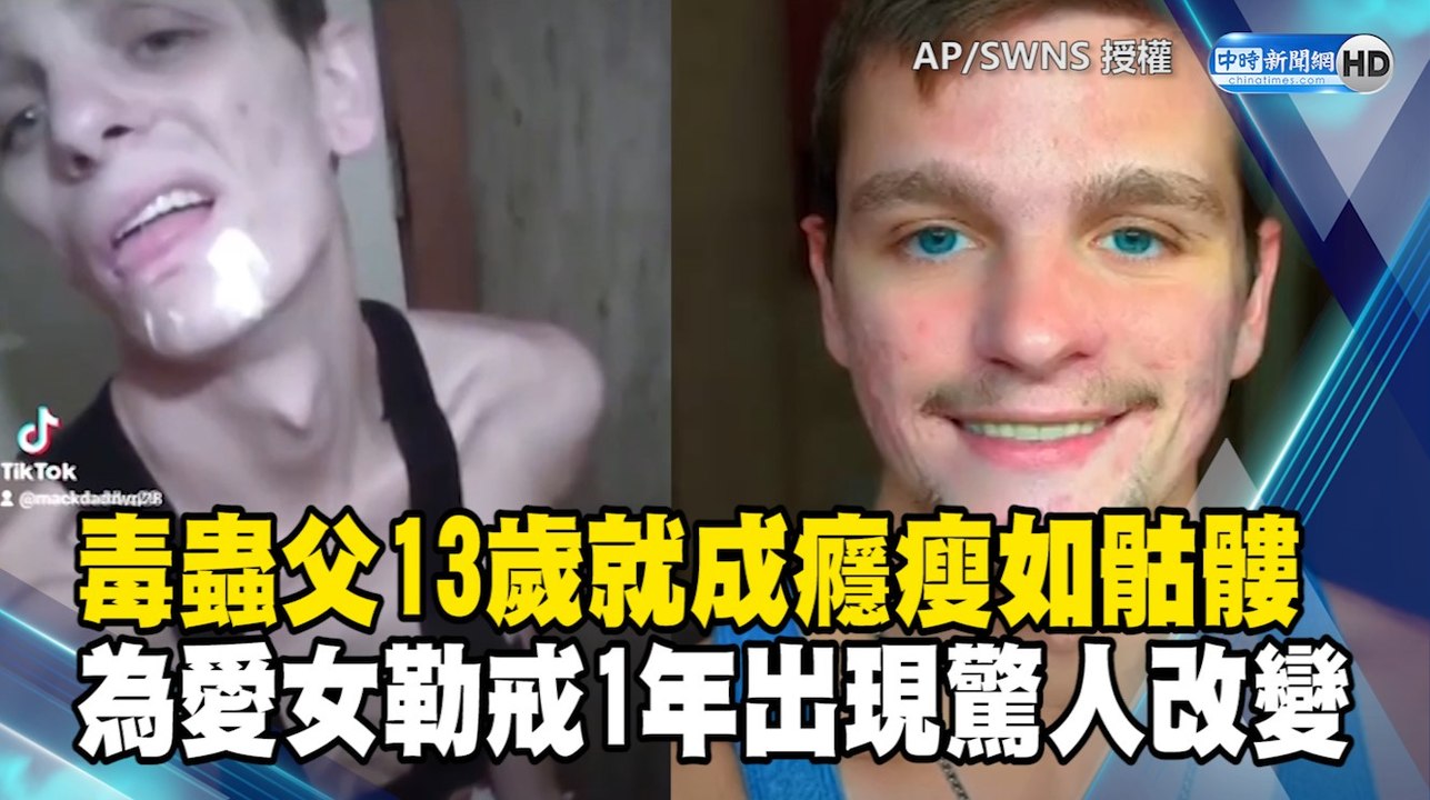 毒蟲父13歲就成癮瘦如骷髏 為女兒勒戒一年出現驚人改變