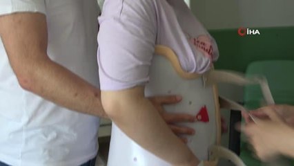 Son dakika haber... 12 yaşındaki çocuk 'skolyoz'dan devlet hastanesinde kurtuldu