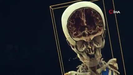 Sinematik gerçeklik ameliyathanelere giriyor