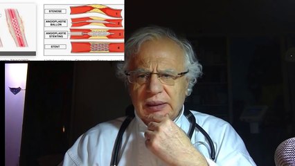 401 SAUVE PAR UN RESSORT DANS LE COEUR INGRATITUDE L' ARTERE DE LA MORT CNV PRESOMPTION IGNORANCE