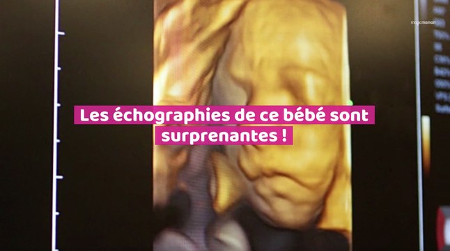 Les échographies de ce bébé sont surprenantes !