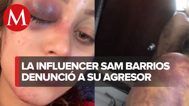 Autoridades en Guanajuato buscan a Carlos Alberto, presunto agresor de Sam Barrios
