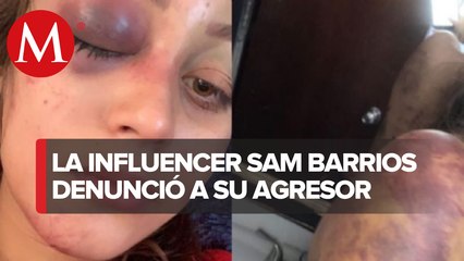 Autoridades en Guanajuato buscan a Carlos Alberto, presunto agresor de Sam Barrios