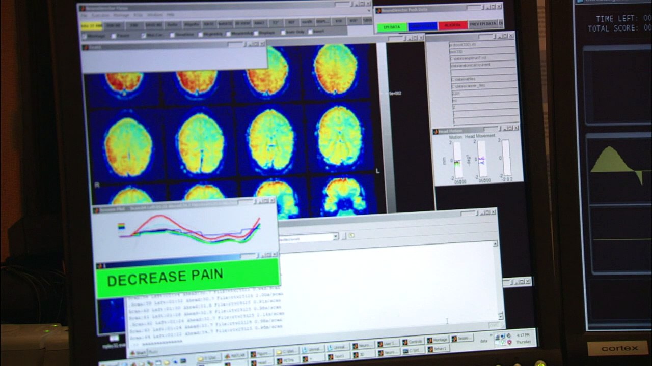 The Brain Revolution