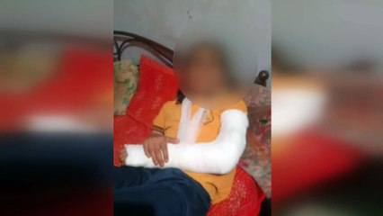 फीस नहीं भरी तो टीचर ने तोड़ा बच्ची का हाथ