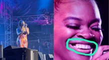 Ari Lennox goes viral for having missing tooth and she handled the jokes with class