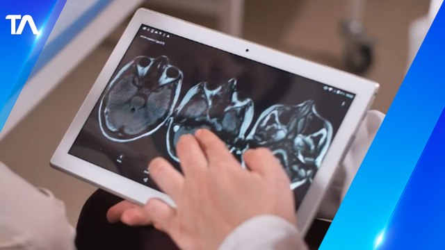 El Parkinson es una enfermedad neurodegenerativa