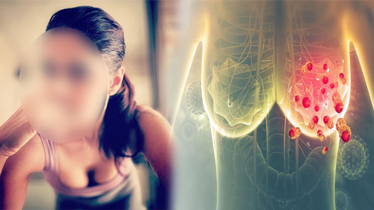 TV Actress Chhavi Mittal को Breast Cancer, Symptoms के साथ Emotional Post Viral | Boldsky