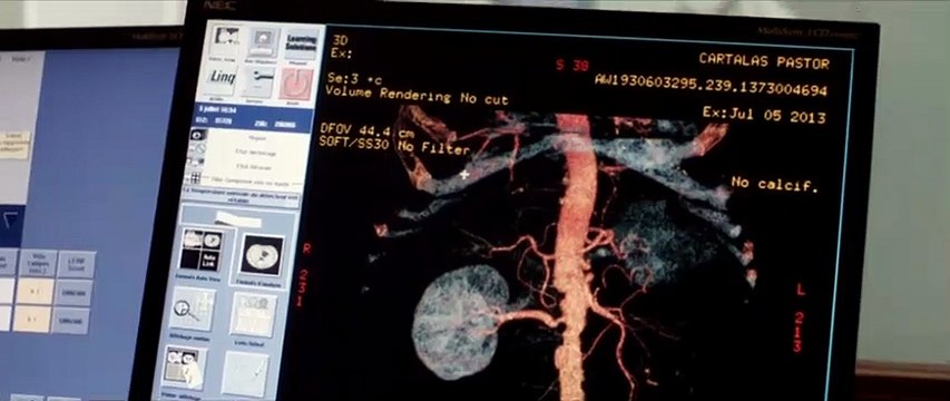 Ablations Bande-annonce VF