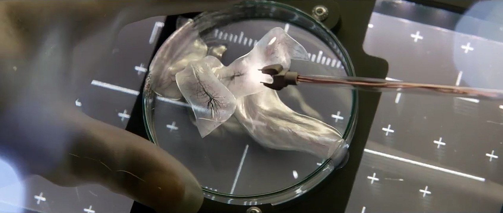 Life - Origine Inconnue EXTRAIT VF "Mutilation"