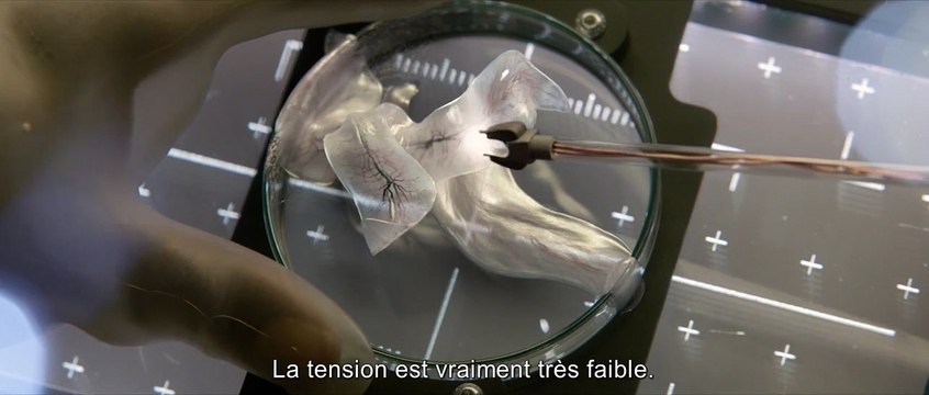 Life - Origine Inconnue EXTRAIT VO Mutilation