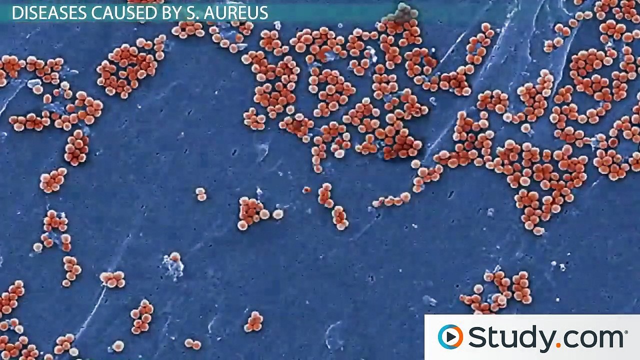 What Is a Staph Infection Causes, Symptoms & Treatments video