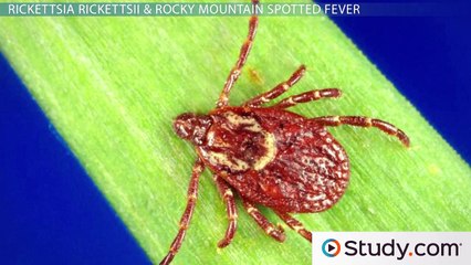 Spotted Fevers- Symptoms of Rickettsia Infections