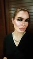 Nadia Hussain Lip Fillers Goes wrong Public Response