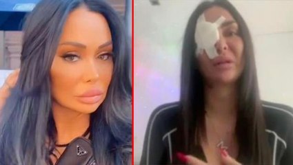 TikTok fenomenine korkunç saldırı! Video çektiği sırada suratına asit attılar