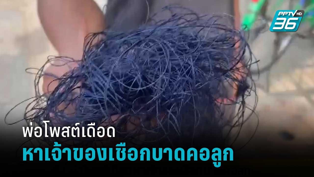 พ่อโพสต์เดือดหาเจ้าของเชือกบาดคอลูก | โชว์ข่าวเช้านี้