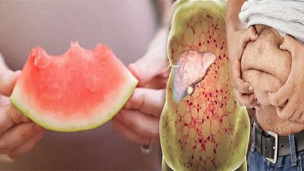 इस तरबूज से किडनी खराब और अंधा होने का खतरा,  कैसे बचे | Boldsky