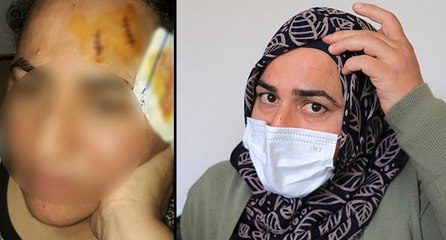 Komşusu yüzüne tencere ile vurdu: Savcılık tencereyi silah saydı