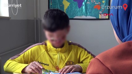 Gözleri kapanan cilt kanseri Salih: Ailemi merak ediyorum, bisiklet sürmek istiyorum