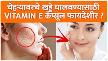 चेहऱ्यावरील खड्डे घालवण्यासाठी काय करावं? | How to Get Rid of Acne Scars | Acne Scars Treatment