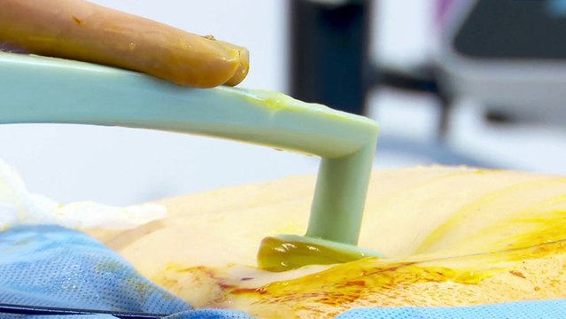 bd-tratamiento-tensar-piel-200422