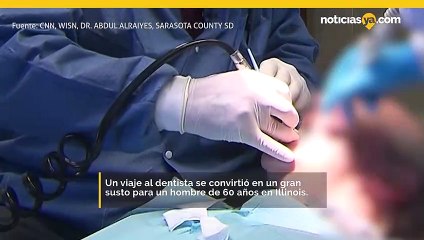 ¡Un extraño accidente convierte una visita al dentista en una visita al médico!