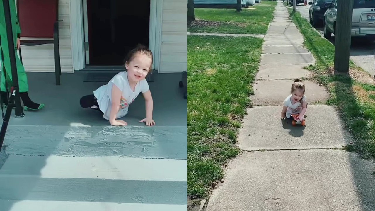 'Resilient 4 y/o girl proving to the world that no challenge in life is unconquerable'