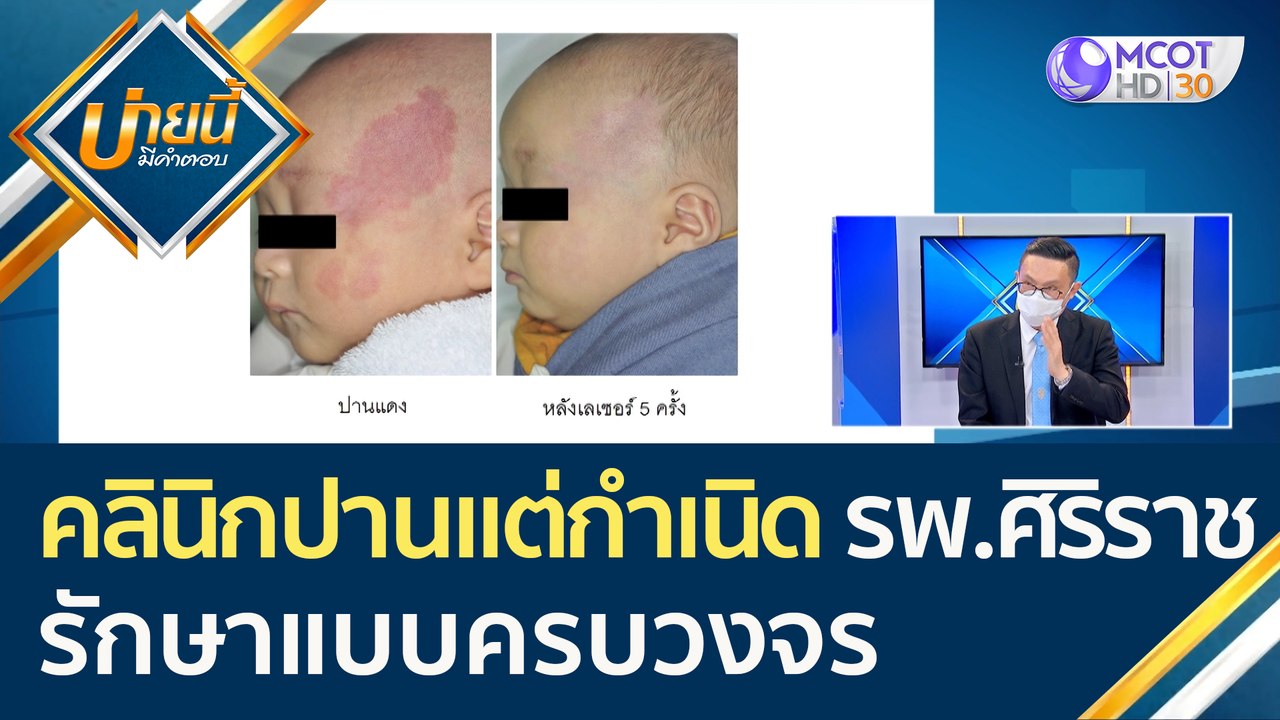 (คลิปเต็ม) "คลินิกปานแต่กำเนิด" รพ.ศิริราช รักษ...