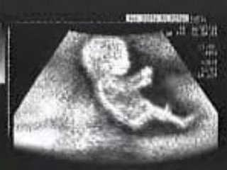 bébé pilote-F1 sur échographie