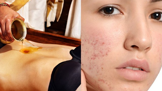 नाभि पर चंदन लगाने के फायदे | Nabhi Par Chandan Lagane ke Fayde| Boldsky