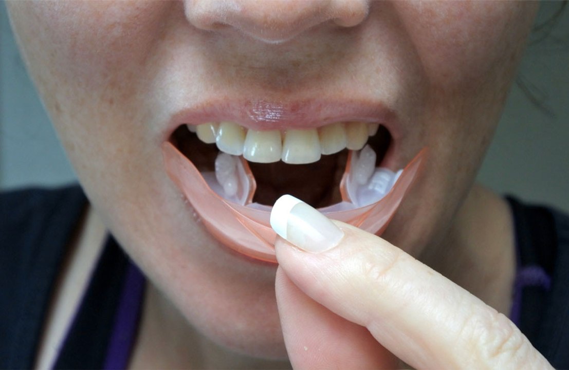 Kissing is as good for teeth as brushing