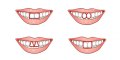Voilà ce que la forme de vos dents révèle de votre personnalité