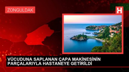 VÜCUDUNA SAPLANAN ÇAPA MAKİNESİNİN PARÇALARIYLA HASTANEYE GETİRİLDİ - YENİDEN