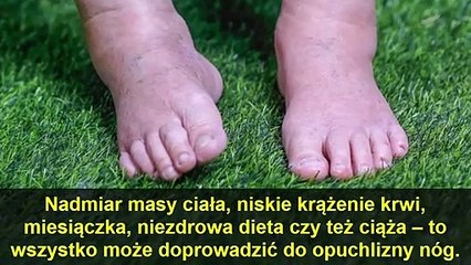 Ta potężna herbatka domowej roboty skutecznie wyleczy twoje opuchnięte nogi w przeciągu kilku dni!