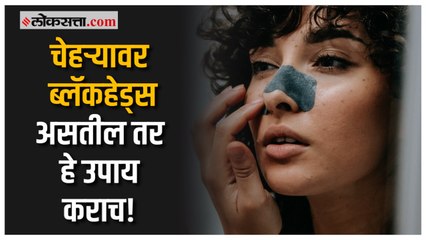 चेहऱ्यावरील ब्लॅकहेड्स घालवण्यासाठी करा 'हे' ५ घरघुती उपाय