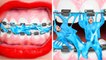 ME VS BRACES Crazy BEAUTY Teen Struggles Funny AWKWARD Relatable Situations by 123GO CHALLENGE