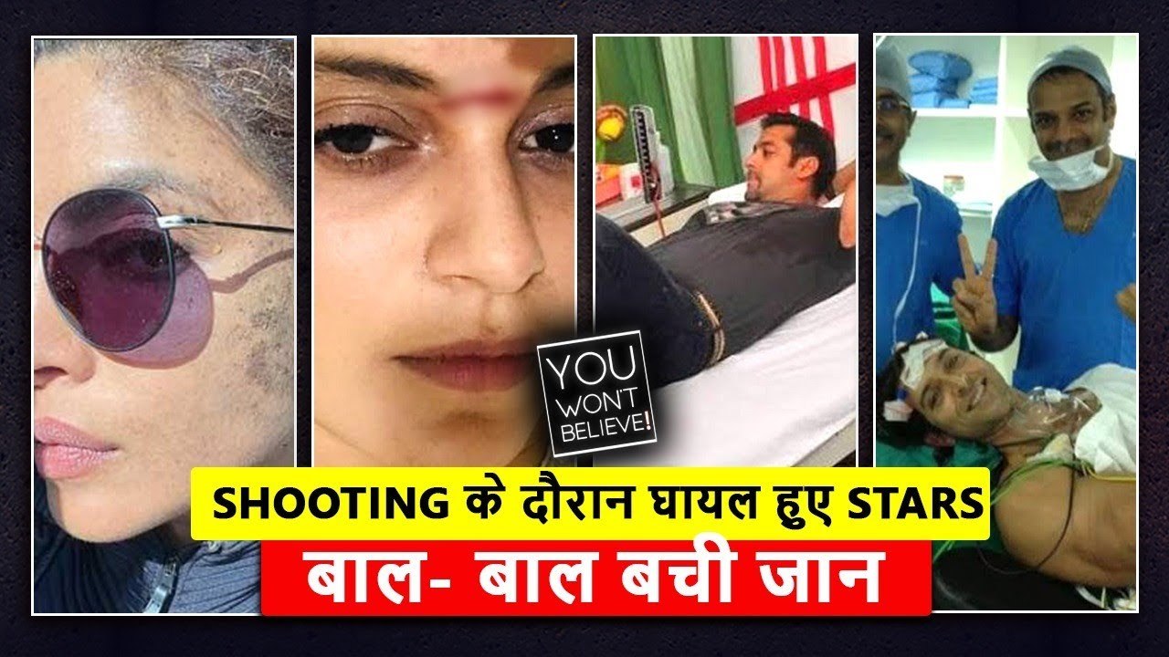 Bollywood Celebs Who Got Badly Injured | Kangana Wounded By Sword, Hrithik's Surgery, Priyanka &More