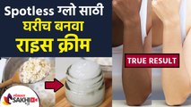 तुम्हाला सुद्धा spotless त्वचा हवी आहे का? | How to Get Spotless Skin Naturally at Home Lokmat Sakhi