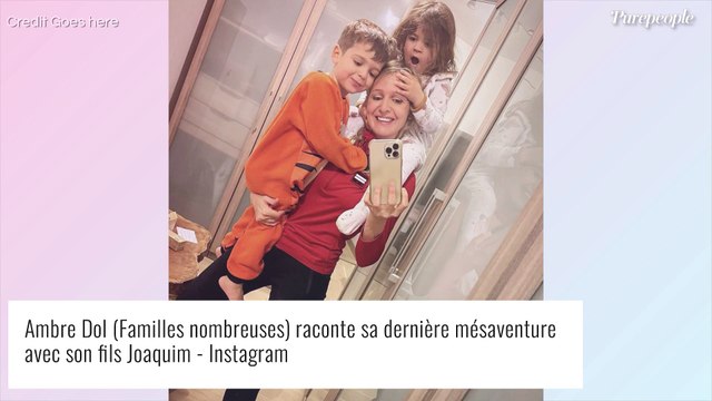 Ambre Dol (Familles nombreuses) opérée du nez : premières images, un oedème et des hématomes sous les yeux