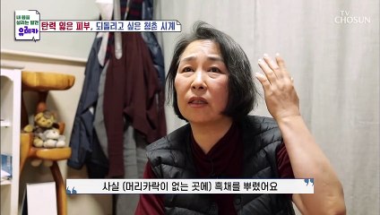부족한 콜라겐 피부 탄력뿐만 아니라 탈모에도 영향을? TV CHOSUN 20220424 방송
