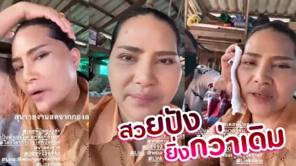 สุนารี ราชสีมา ปลื้มหนัก หลังศัลยกรรมดึงหน้า เผยมีแต่คนชมตาสวย คิ้วสวย