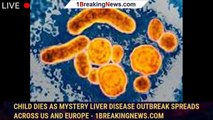 Child dies as mystery liver disease outbreak spreads across US and Europe - 1breakingnews.com