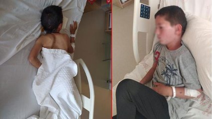 Uçurtmasının peşinden koşan çocuğa 6 köpek birden saldırdı, yardımına sesleri duyan çoban koştu