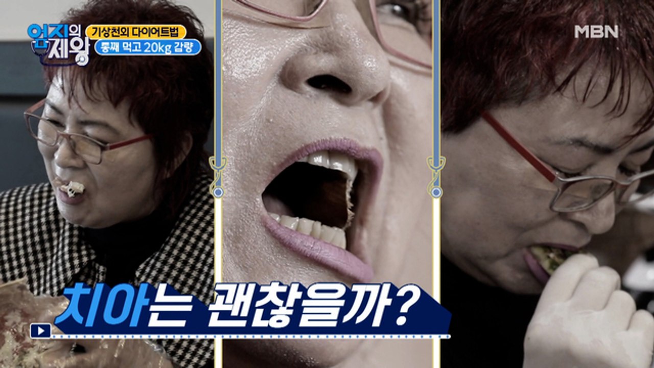통째 먹고 20kg 감량, 다이어트 달인의 치아 상태는?